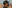 important hair transplant recovery tips from Nashville Hair Doctor