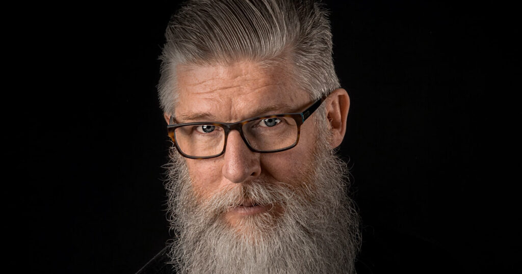 Man after grey hair transplant in Nashville, TN.