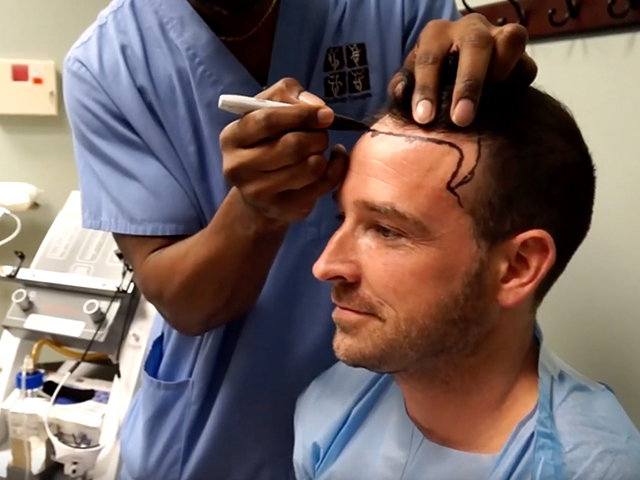 Nashville Hair Doctor patient journey - designing the new hairline
