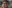 Nashville hair doctor hairline restoration timeline in pictures