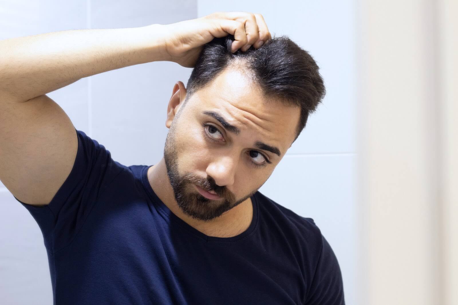 The Psychology of Hair Loss Understanding the Mental Impact of Hair