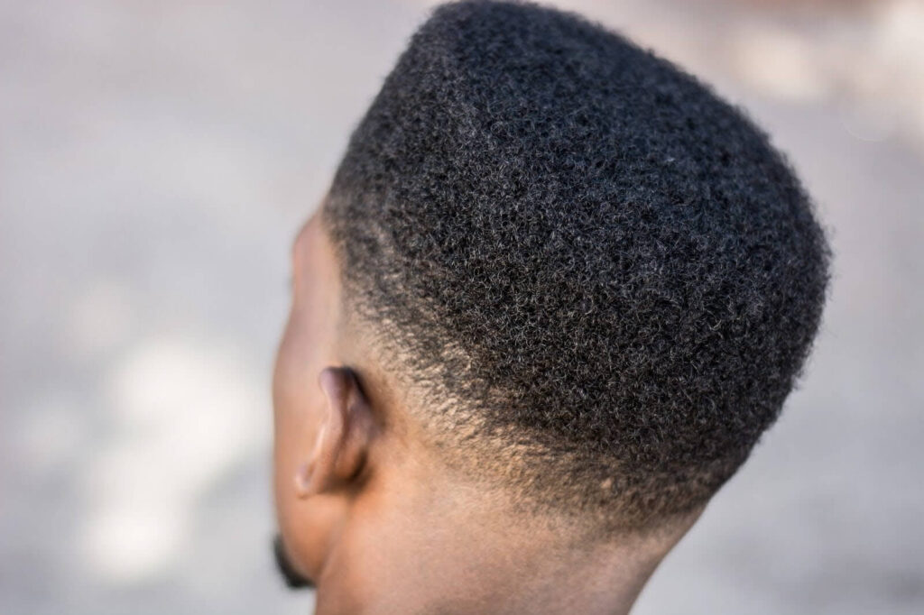 A man after hair restoration in Nashville, TN.